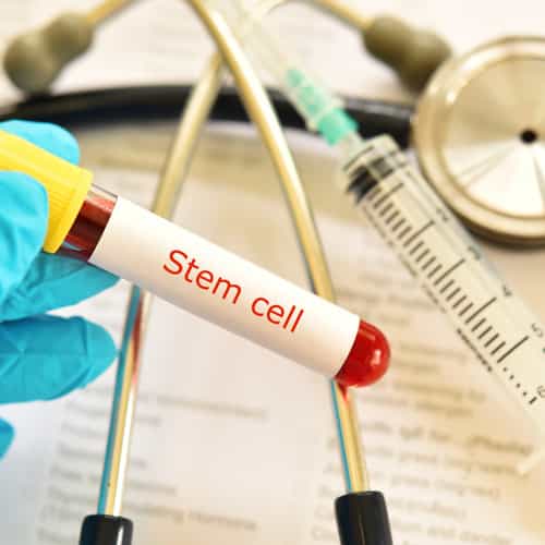 Why Patients from China Choose Japan for Advanced Stem Cell Therapy